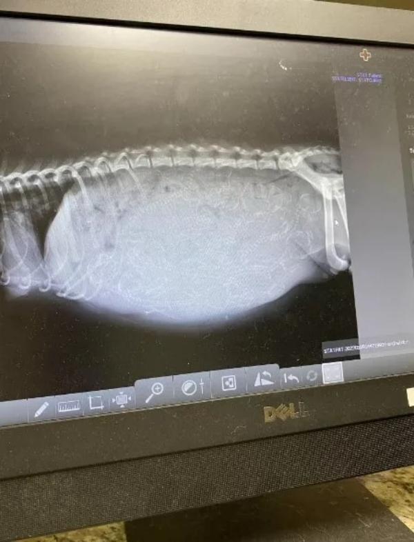 xray showing nothing