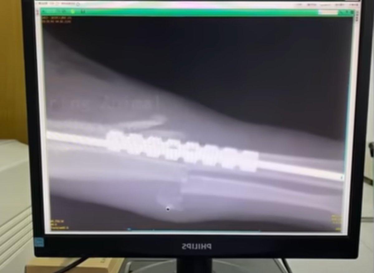 xray of spike xray of spike